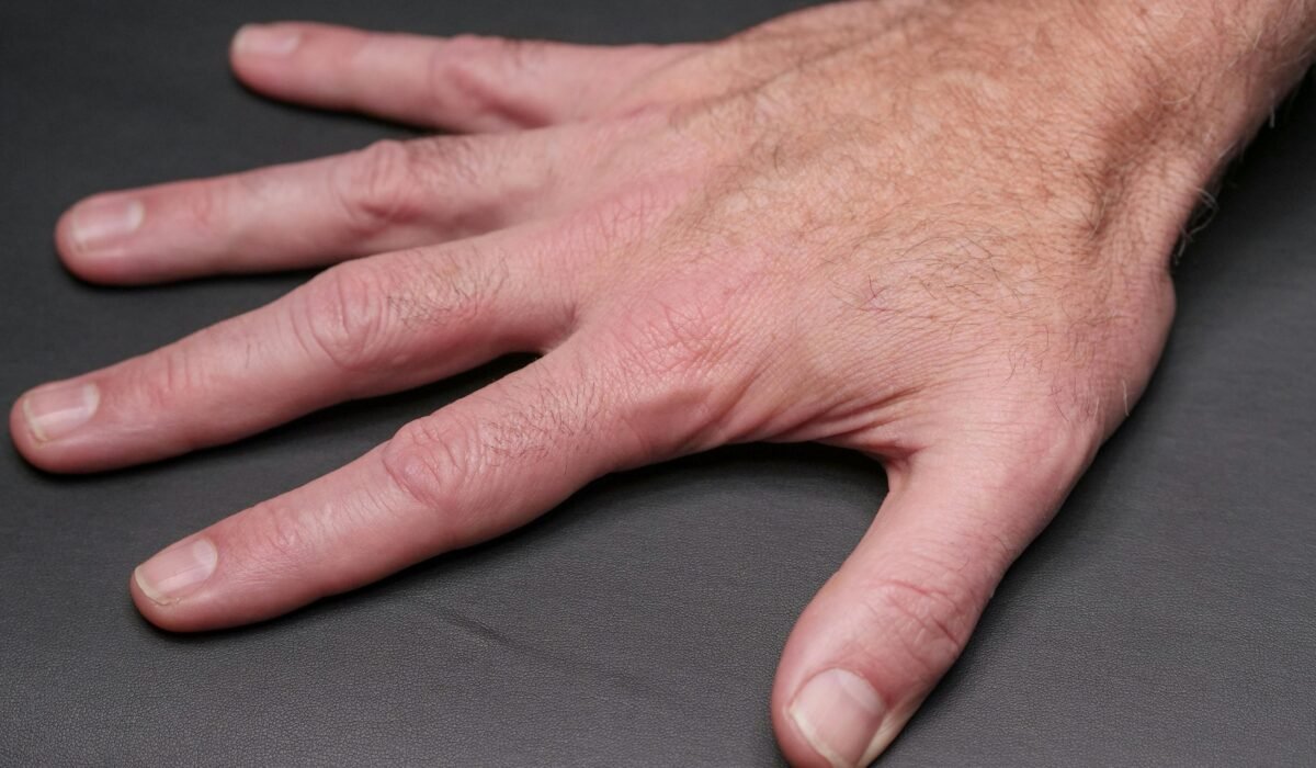 🌿 ProNail Complex Review 2025 – Proven Benefits for Nail Health and Fungus Treatment with Natural Antifungal Formula